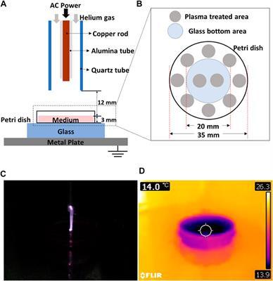 Suppression of Breast Cancer Cell Migration and Epithelial-Mesenchymal Transition by Atmospheric Pressure Plasma